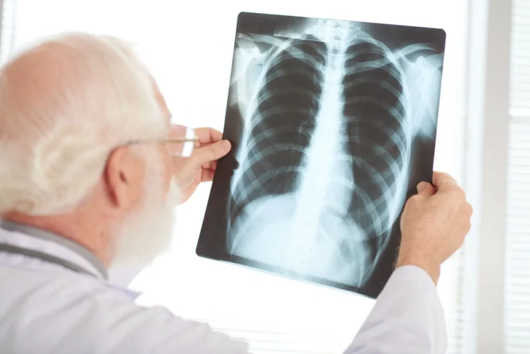 4 Manfaat Vaksin Pneumonia Dewasa untuk Tubuh Sehat dan Produktif