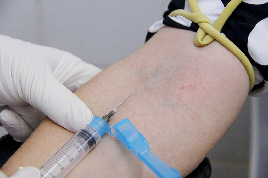 Kapan Waktu Terbaik Melakukan Infus Zat Besi?