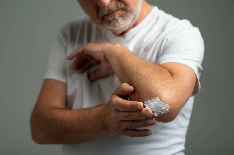 Mengapa Penyakit Kulit pada Lansia Rentan Terjadi?