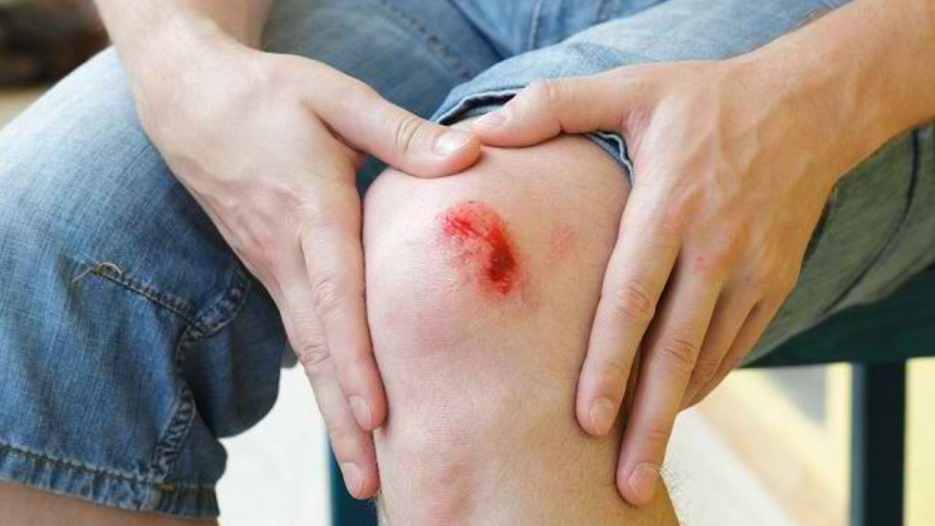 Perawatan Luka Akut dan Kronis dengan Metode Modern untuk Lansia