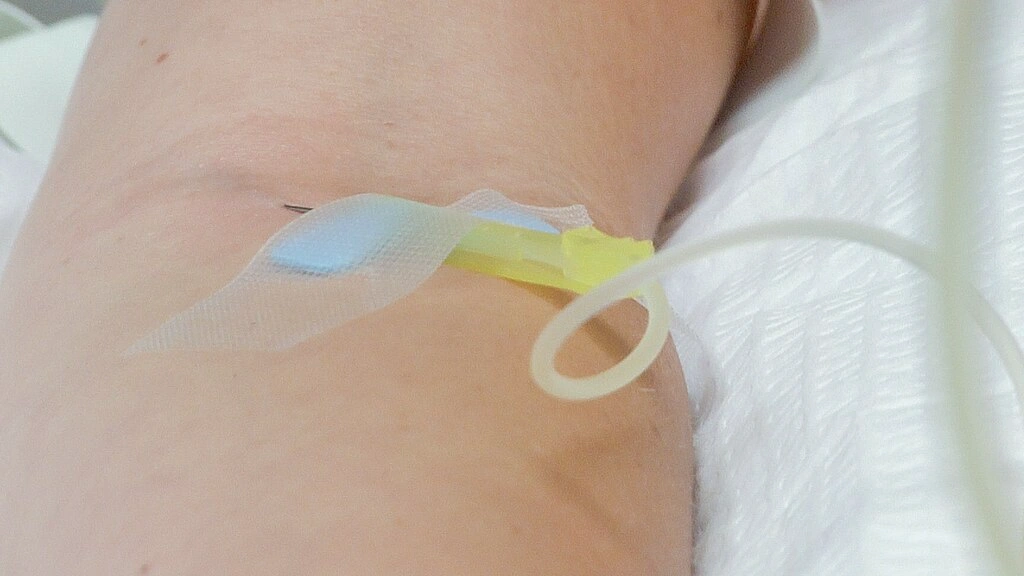 Bisakah Infus Nutrisi Parenteral Ditanggung BPJS?