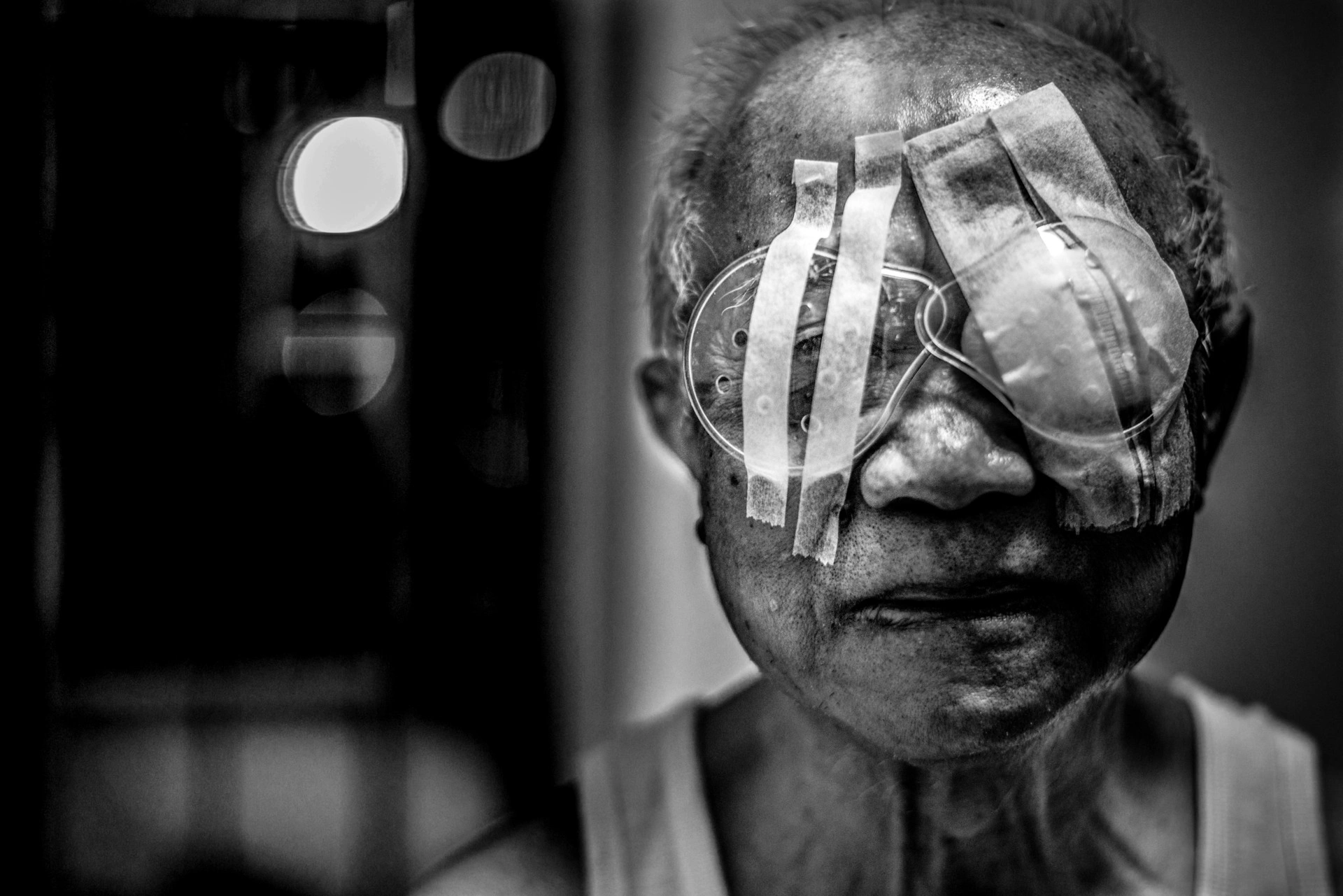 Berapa Biaya Operasi Katarak Lansia? Ini Estimasi dan Hal yang Perlu Anda Siapkan