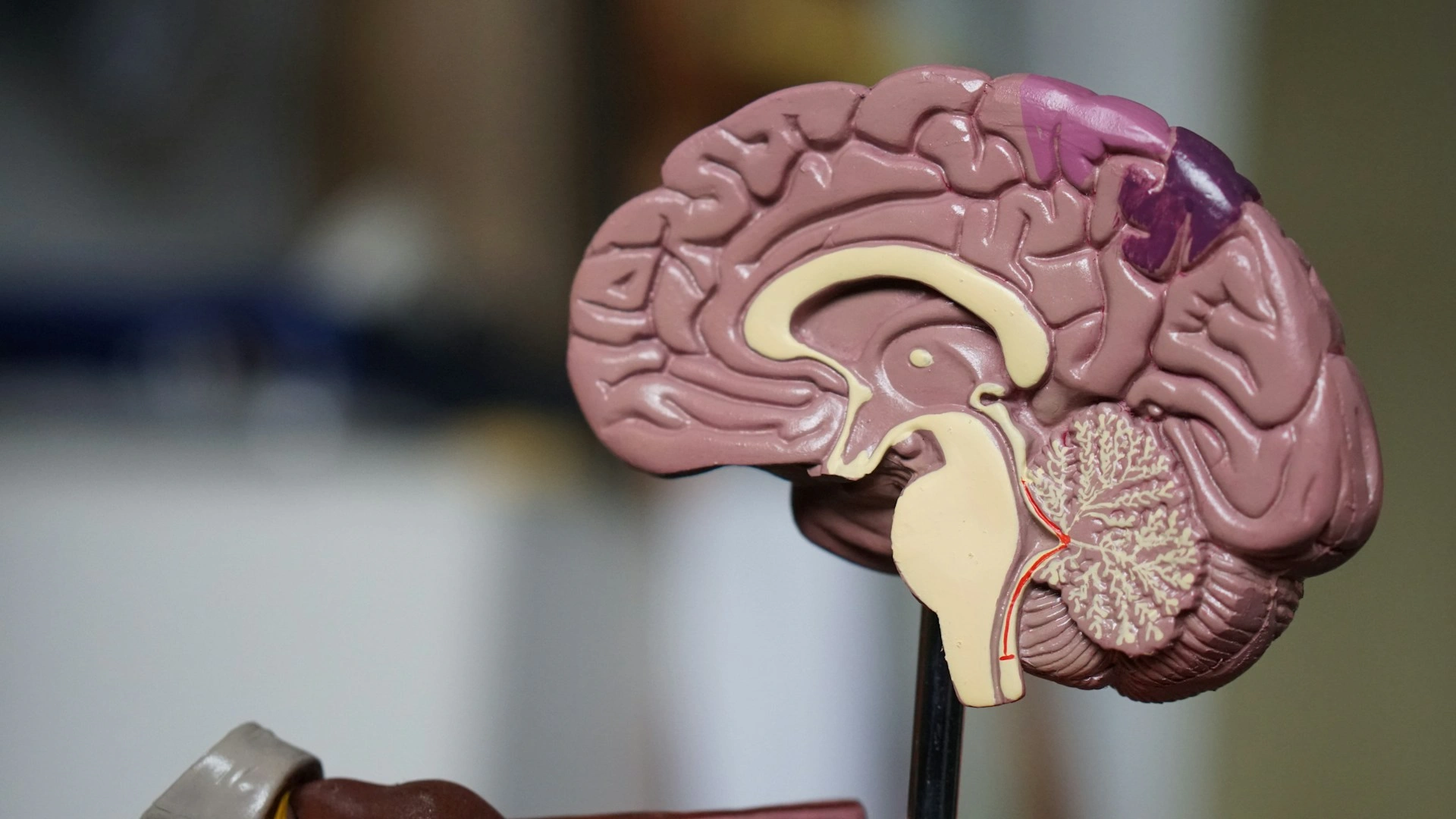 Sering Lupa? Kenali Gejala Alzheimer pada Lansia dan Cara Menghadapinya